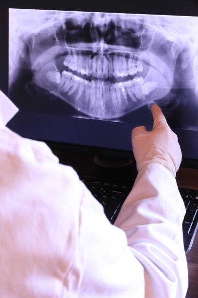 Best Emergency Dental Care for Broken or Chipped Teeth in Westmont, CA