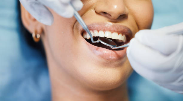 Best Emergency Treatment for Dental Infections or Abscesses in Westmont, CA